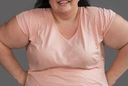 Nghiên cứu mới cho thấy béo phì làm tăng 70% nguy cơ nhiễm trùng nặng