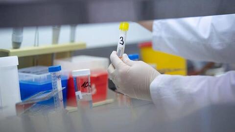 6.650/7.264 mẫu xét nghiệm ở Bệnh viện Bạch Mai âm tính với SARS-CoV-2