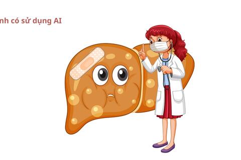 Gan nhiễm mỡ là "tín hiệu cảnh báo" rối loạn chuyển hóa