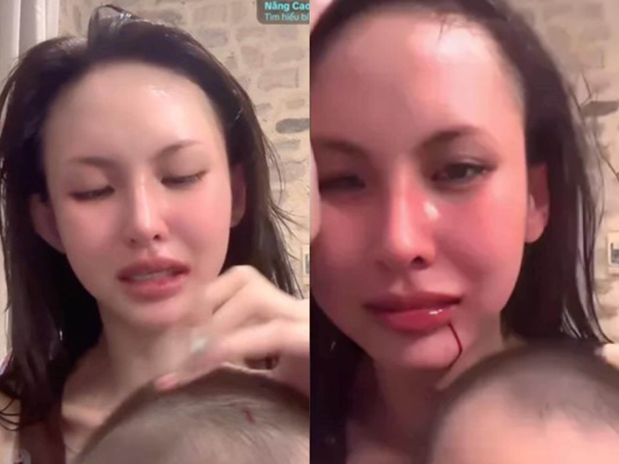 Lâm Minh xuất hiện trên livestream, tố bị chồng và mẹ chồng bạo hành. Ảnh: chụp màn hình