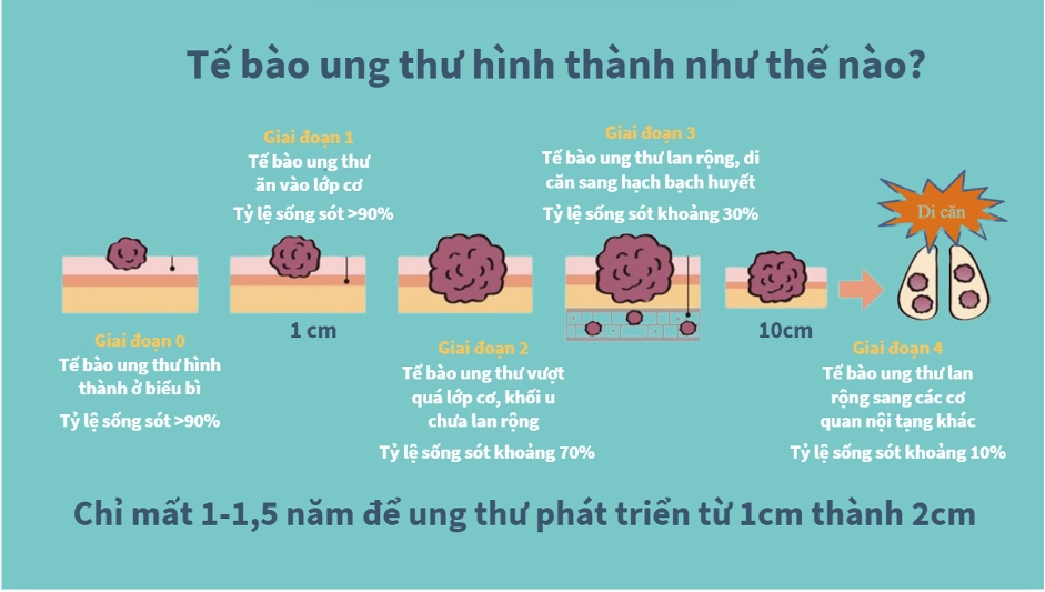 Ảnh quá trình tế bào ung thư hình thành và phát triển. Nguồn: NURA