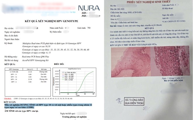 Hai năm trì hoãn khám, người phụ nữ phát hiện tiền ung thư