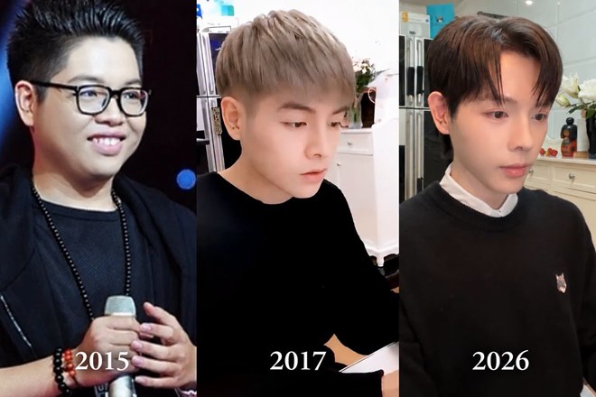 Ca sĩ Đức Phúc: Chấn thương mũi 2023 khiến tôi quyết định thẩm mỹ lần 2 sau 9 năm
